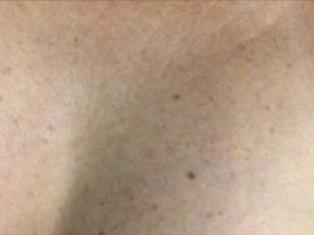 Εκπομπές οθόνης Alianakiss